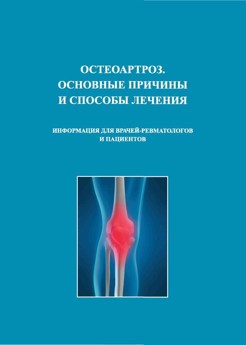 Остеоартроз