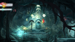 * Child of Light* Ultimate Edition Xbox активация