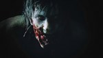 *RESIDENT EVIL 2 / BIOHAZARD RE:2 XBOX One КЛЮЧ *GLOBA
