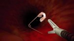 Revenge Of The Colon * АВТОДОСТАВКА STEAM РОССИЯ