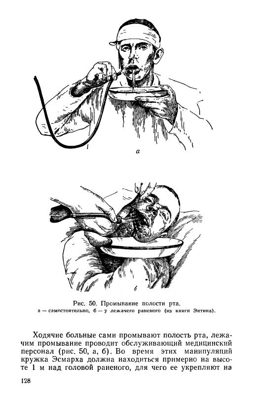 Уход за полостью рта больного. Промывание ротовой полости. Промывание полости рта пациенту. Кружка Эсмарха промывание рта. Болезни ротовой полости книга.