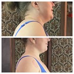 Видео урок массаж дренаж для уменьшения объёмов тела