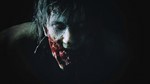 ✅❤️RESIDENT EVIL 2❤️XBOX ONE|XS🔑KEY+VPN✅