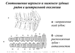 Варианты прикусов у человека