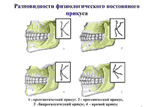 Варианты прикусов у человека
