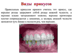 Варианты прикусов у человека